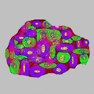 fakeacan (2)  Only $50 a polyp ;)
