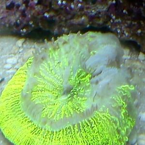 Trachy deteriorating