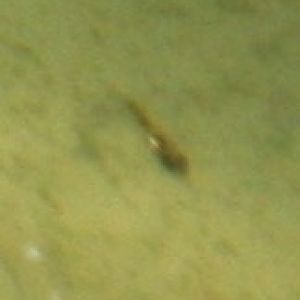 day 1 GBM close up.jpg